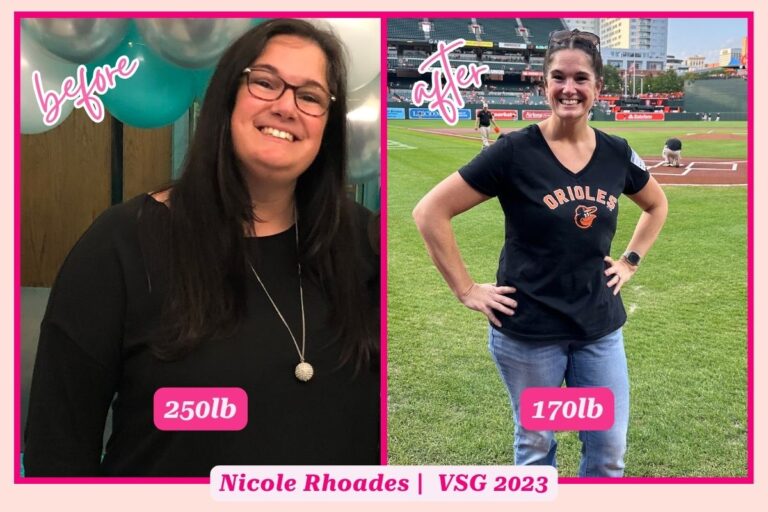 Gastric Sleeve Before and After (20+ Photos!) - The Sleeved Dietitian ...