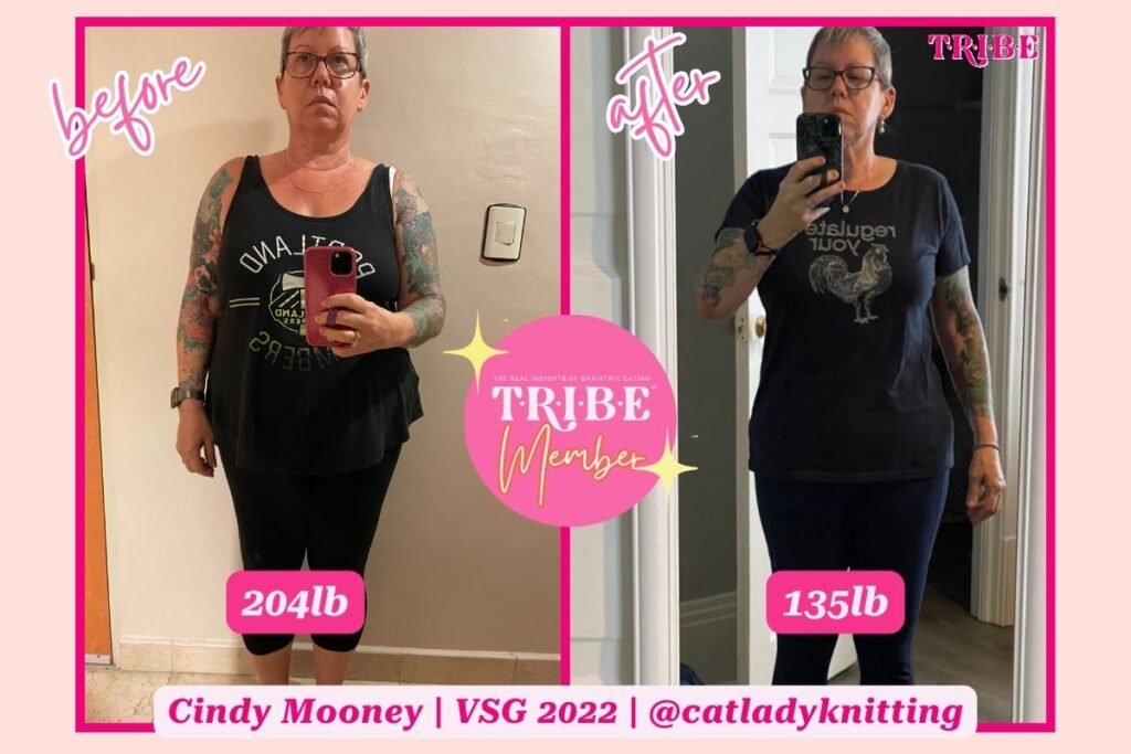 gastric sleeve before and after photo of plus size woman on the left and smaller version of the same woman on the right with T.R.I.B.E. member badge