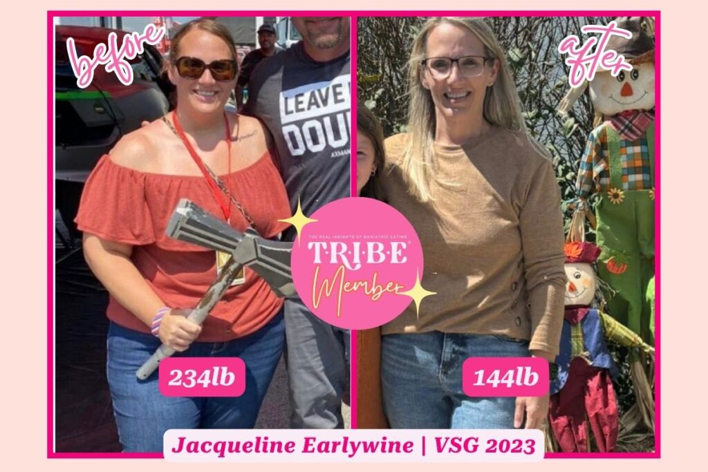 gastric sleeve before and after photo of plus size woman on the left and smaller version of the same woman on the right with T.R.I.B.E. member badge