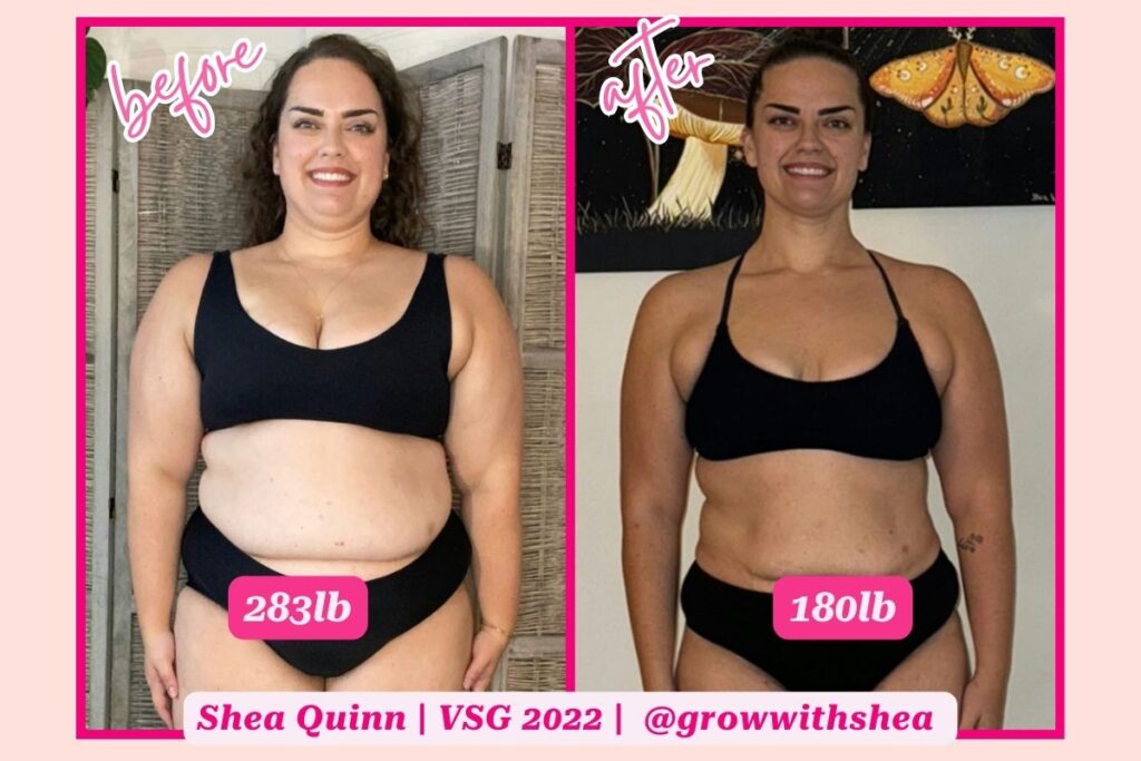 gastric sleeve before and after photo of plus size woman on the left and smaller version of the same woman on the right 