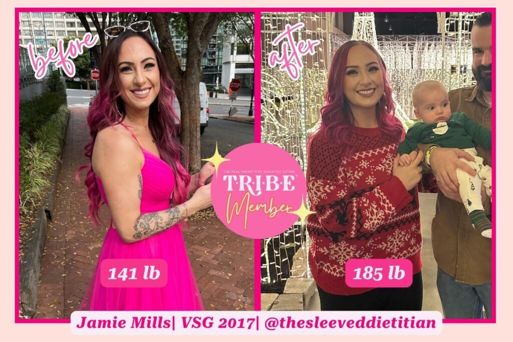 gastric sleeve before and after photo of plus size woman on the right and smaller version of the same woman on the left with T.R.I.B.E. member badge