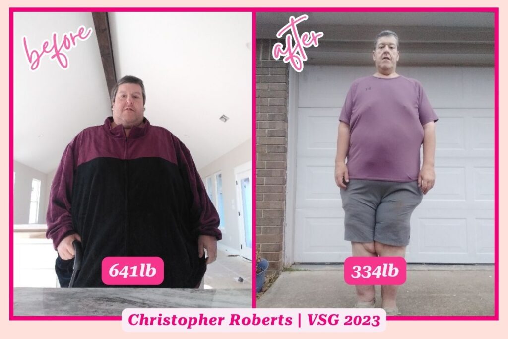 gastric sleeve before and after photo of plus size man on the left and smaller version of the same woman on the right 