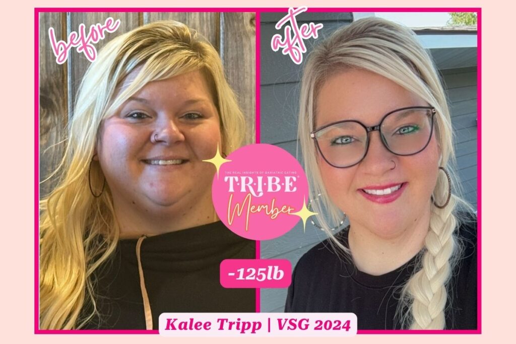 gastric sleeve before and after photo of plus size woman on the left and smaller version of the same woman on the right with T.R.I.B.E. member badge