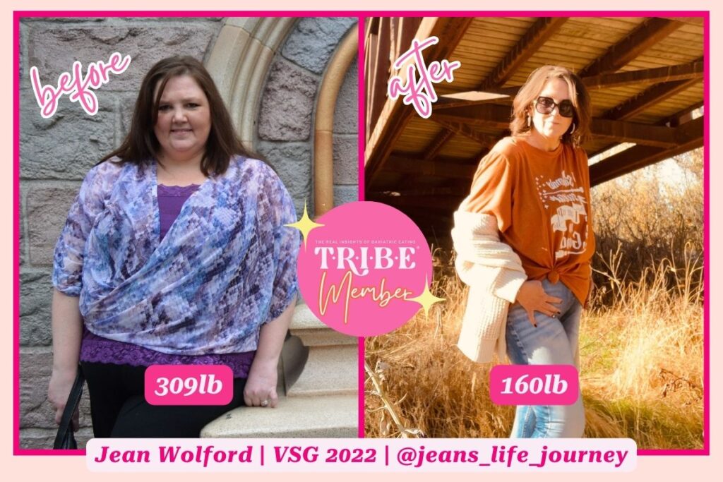 gastric sleeve before and after photo of plus size woman on the left and smaller version of the same woman on the right with T.R.I.B.E. member badge